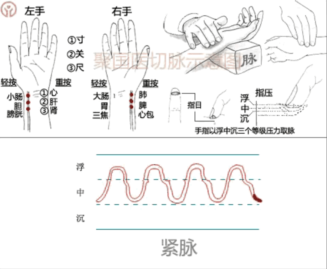 中医养生之脉诊与健康预警的奥秘