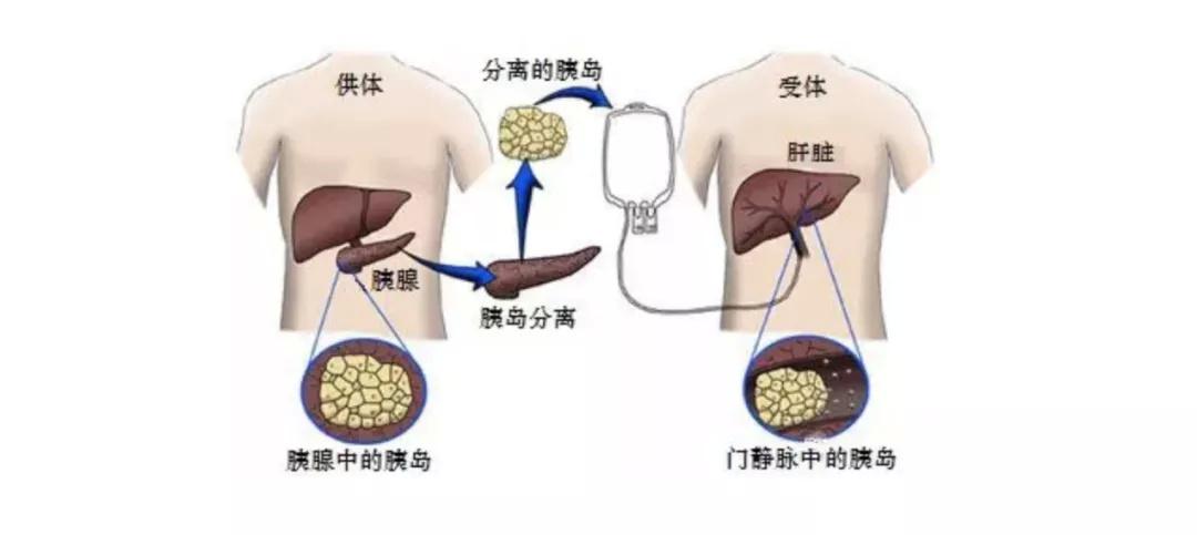 肝脏疾病病因分类与不同治疗方式的深度解析