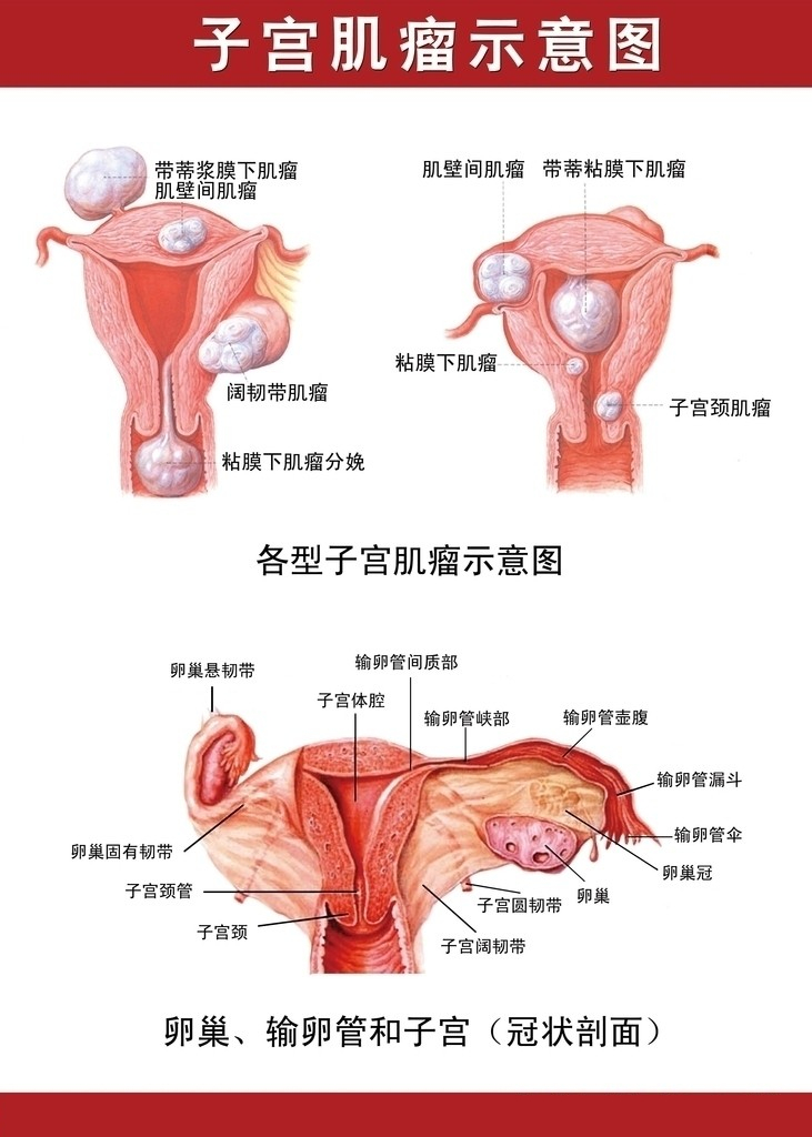 女性子宫肌瘤治疗选择与术后关键注意事项解析